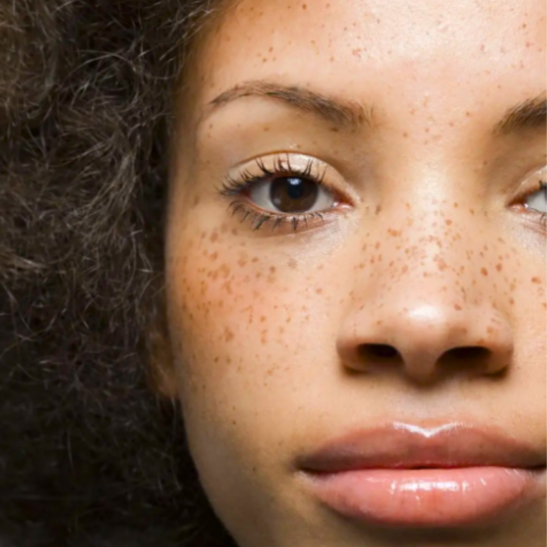Tâches de rousseur en Maquillage Permanent